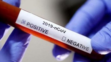 कोरोना संक्रमणबाट मृत्यु हुनेको संख्या ६ पुग्यो, एकै दिन १७० थपिदा संक्रमित संख्या १२१२