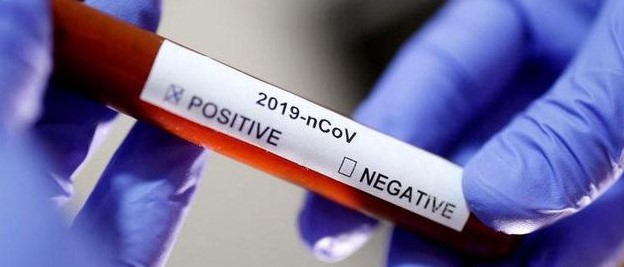 नवलपुर : सँक्रमित ३ जना सहित सातैजनाको रिपोर्ट नेगेटिभ