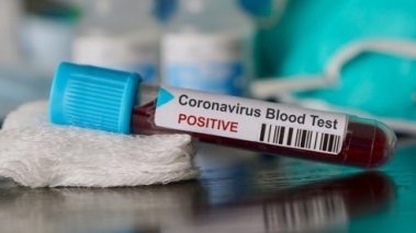 २६ जनामा कोरोना पुष्टि : संक्रमितको संख्या २४३ पुग्यो