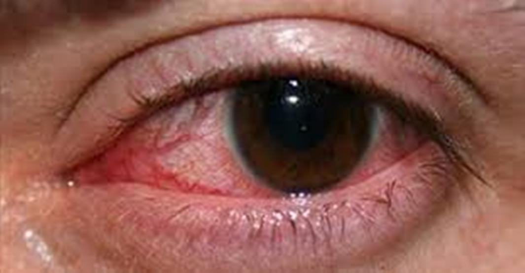 फार्मेसी संघ रुपन्देहीद्वारा विद्यार्थीको निःशुल्क आँखा परीक्षण